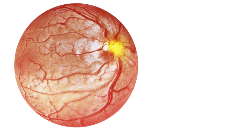 Retina Poliambulatorio Ugobassi Scansione con OCT